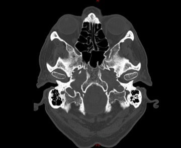 headhole07.JPG