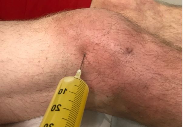 knee dwaw.JPG