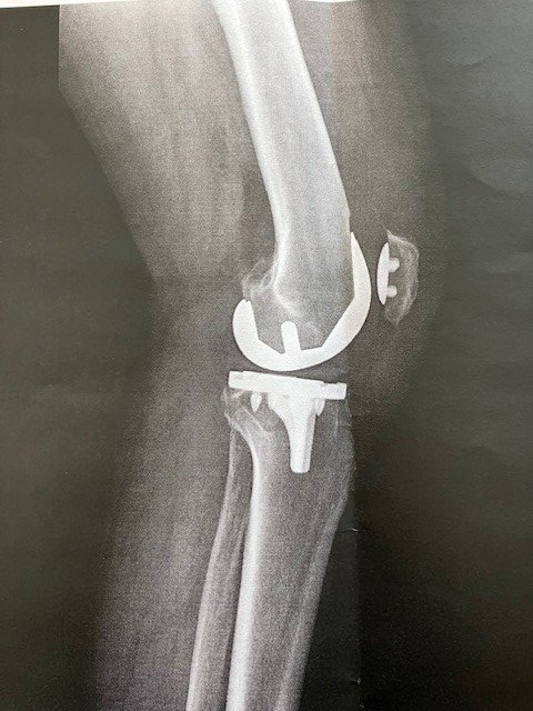 New Knees 3.jpg