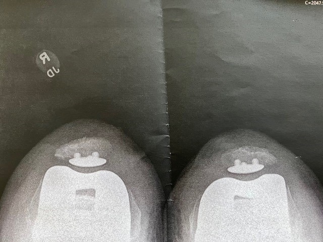 New Knees 4.jpg