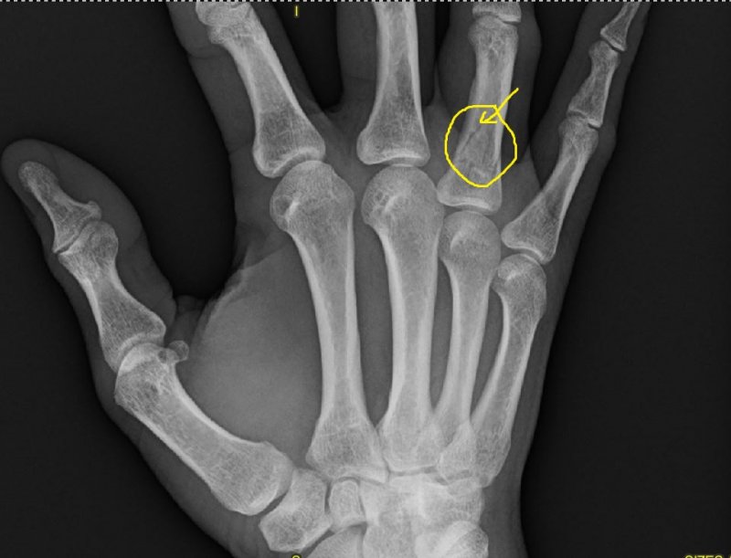 right hand.JPG