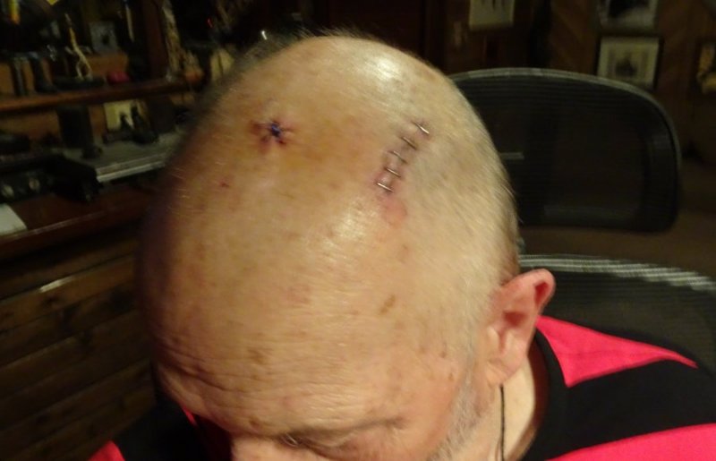 Staples01.jpg