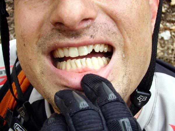 tooth.jpg