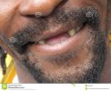 big-gap-8828958.jpg